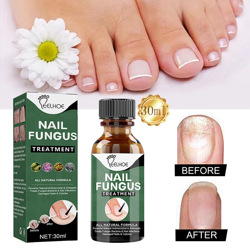 Magic Fast Remover Gel Nail Polish